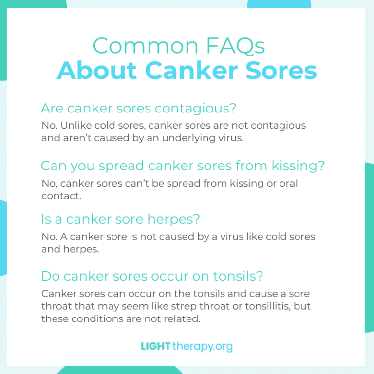 Canker Sore FAQs Light Therapy