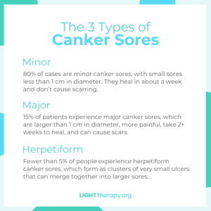 canker sores