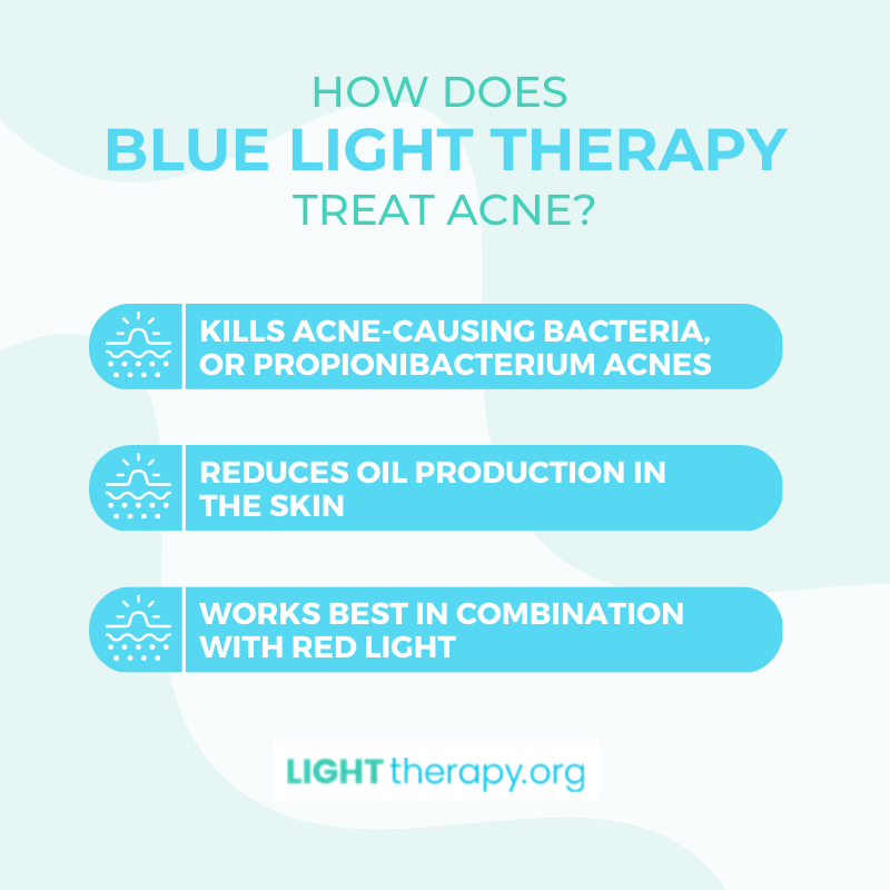 Infographic: Blue Light Therapy for Acne, Before and After: What to Expect