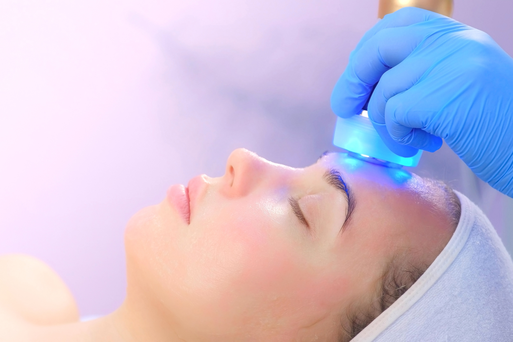 red and blue light therapy for cystic acne